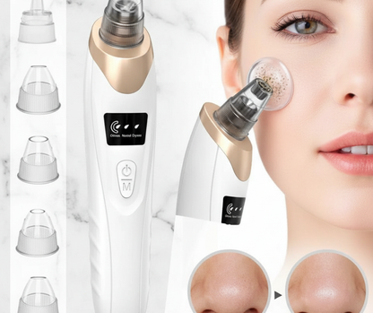 5 in 1 Electric Blackhead Remover Vacuum – Face Pore Cleaner & Acne Oil Suction Machine. blackhead remover, pore cleaner, acne remover tool, face vacuum cleaner, skincare device