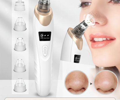 5 in 1 Electric Blackhead Remover Vacuum – Face Pore Cleaner & Acne Oil Suction Machine. blackhead remover, pore cleaner, acne remover tool, face vacuum cleaner, skincare device